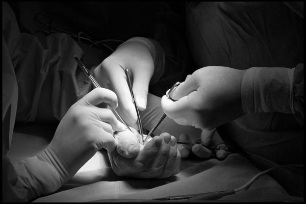 Patologie interessate alla chirurgia della mano